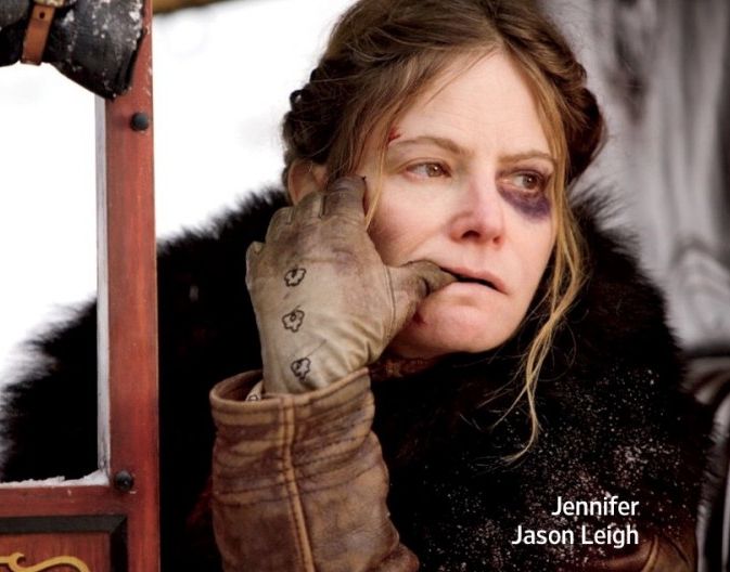 Jennifer Jason Leigh and her black eye